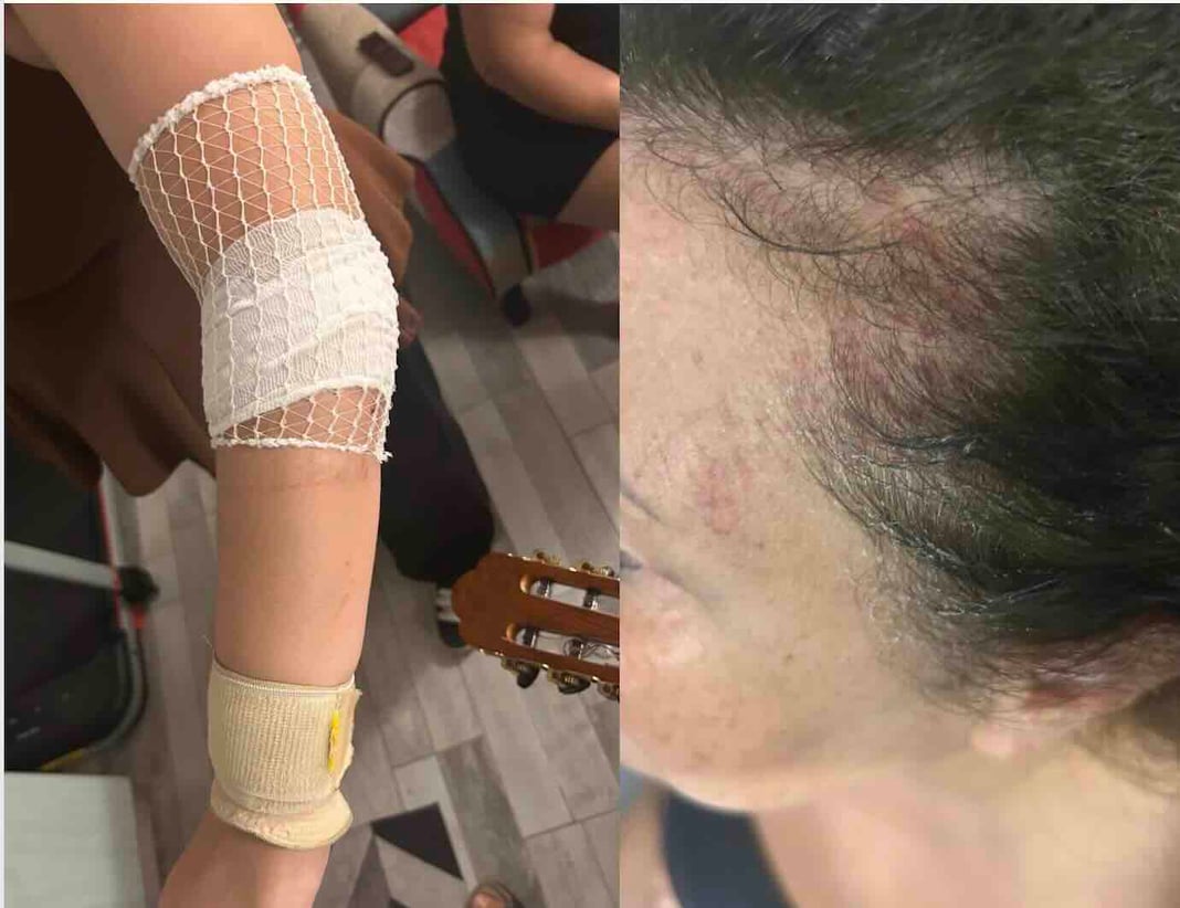 Napoli, pirata della strada investe madre e figlia e fugge